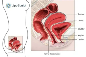 Treatment For A Leaky Bladder 2 How EM Chair treatment Loughborough can help Leaky bladder issues. Read more now!