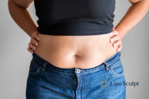 Bidding Farewell to Muffin Tops with Aqualyx Fat Injections 2 Do you wish you could reduce your muffin top Loughborough With Aqualy fat dissolving injections you can!