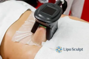 Does Fat Freezing At Home Work? 3 Fat freezing at home from Lipo Sculpt Loughborough